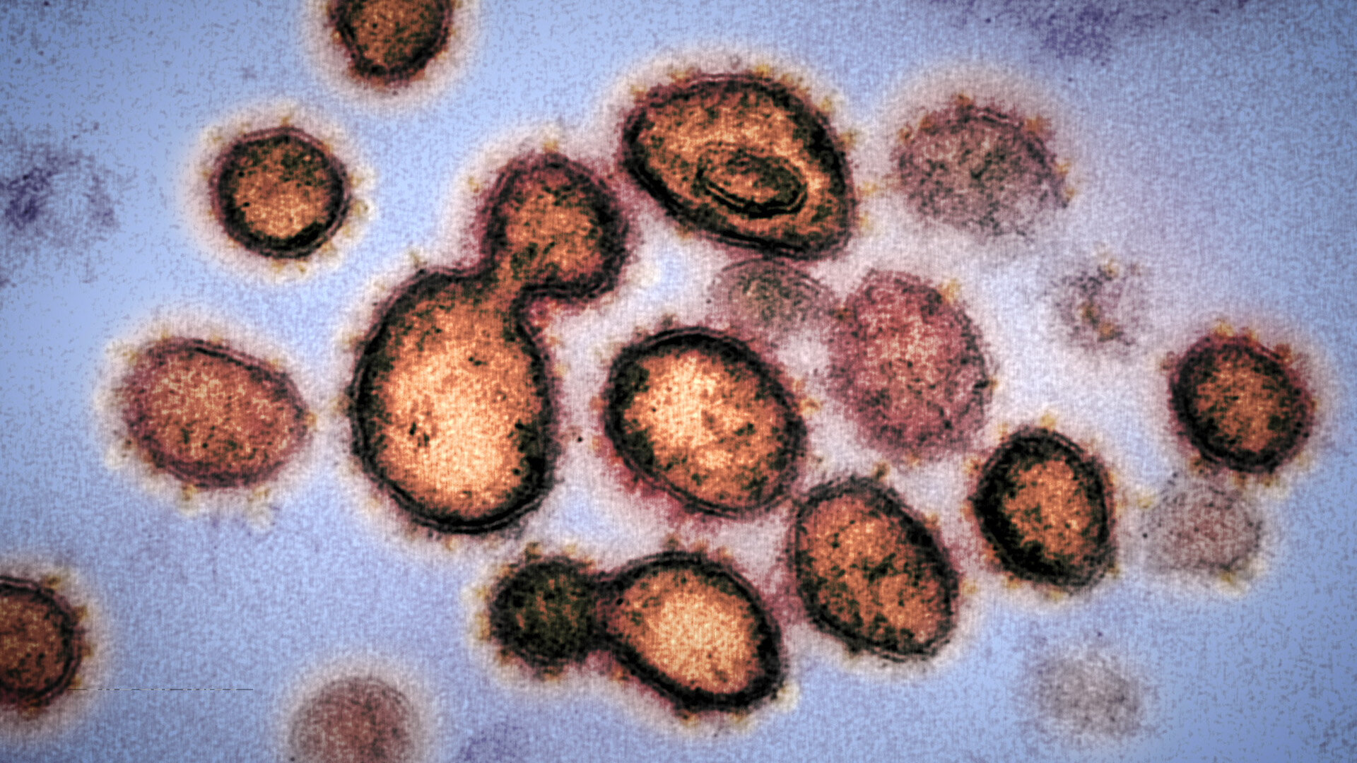 Coronavirus, Explained